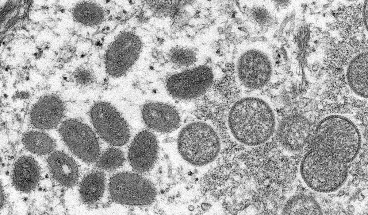 Monkeypox virus